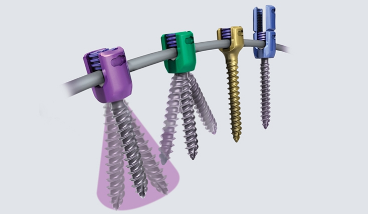 Armada Spinal System