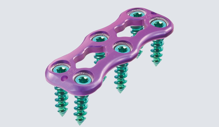 Helix ACDF system
